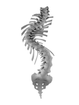 Adolescent Idiopathic Scoliosis Single Major 3