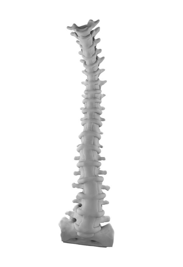 Adult Degenerative Spine
