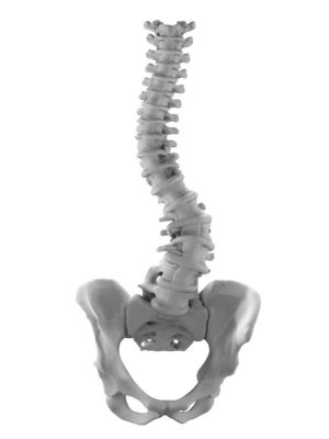 Adult Idiopathic / Latrogenic Scoliosis Apex L2