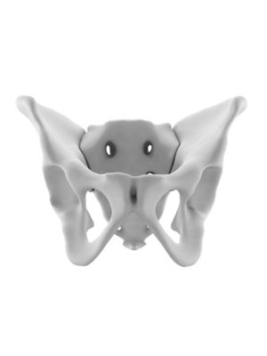 Dysmorphic Male Pelvis