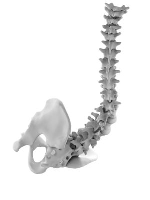 Neuromuscular Deformity