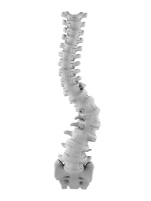 Adult Degenerative Thoracolumbar Scoliosis
