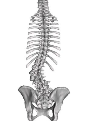 Adult Degenerative Mobile Scoliosis Apex L2
