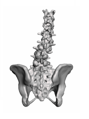 NuVasive Lumbar Training Model
