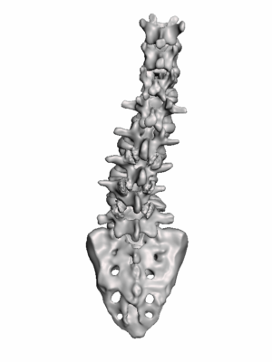 Moderate Lumbar Training Model