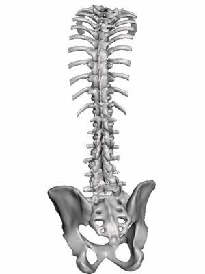 NuVasive XLIF Model