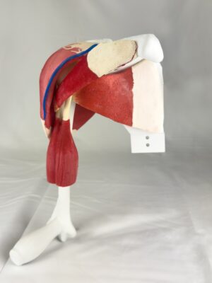 Comprehensive Shoulder - Uncasted