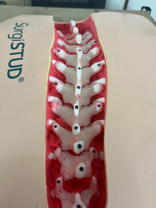 Adult Normal Spine m.Stryker Fiducial T1-P - Image 3