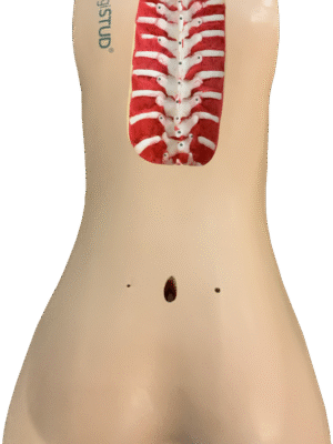 Adult Normal Spine m.Stryker Fiducial T1-P