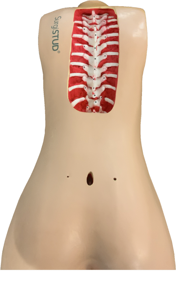 Adult Normal Spine m.Stryker Fiducial T1-P