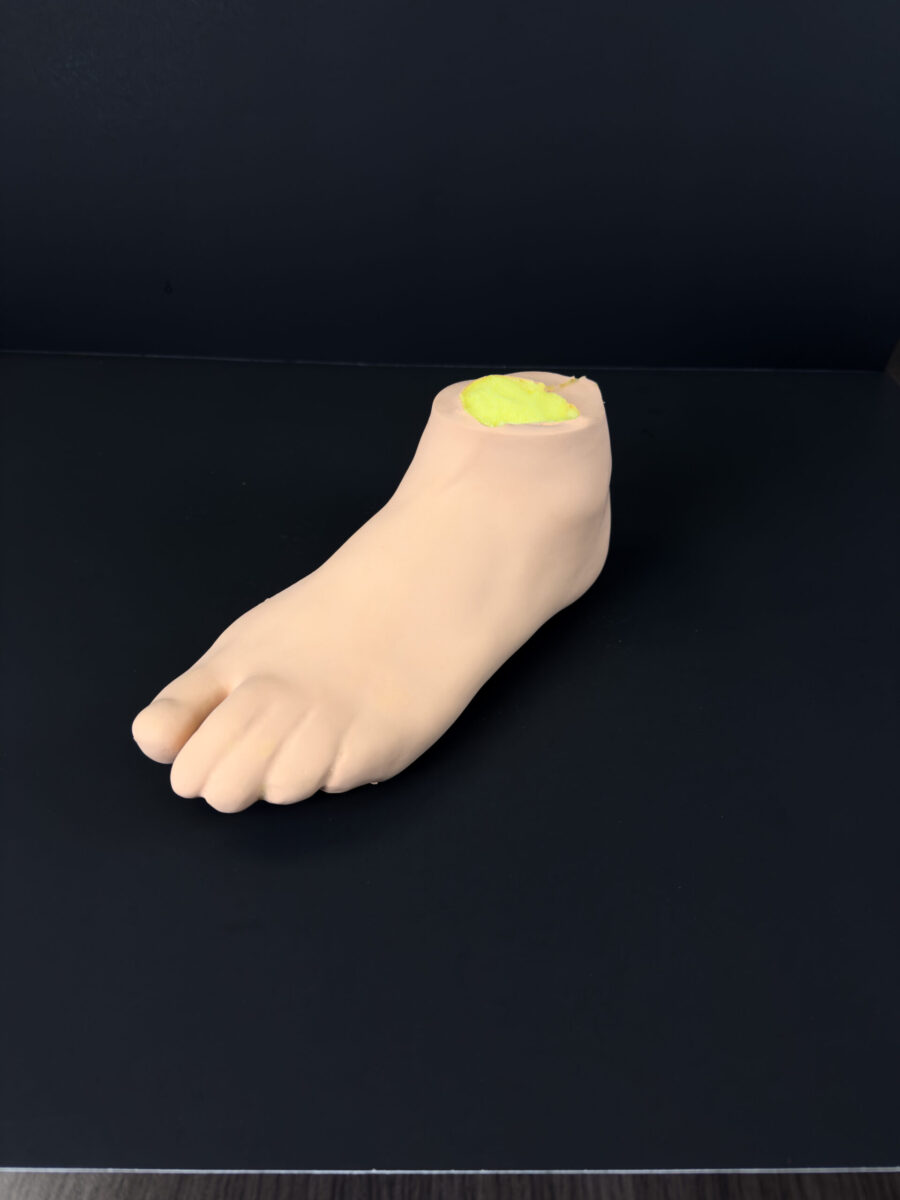Streamlined Bunion Model