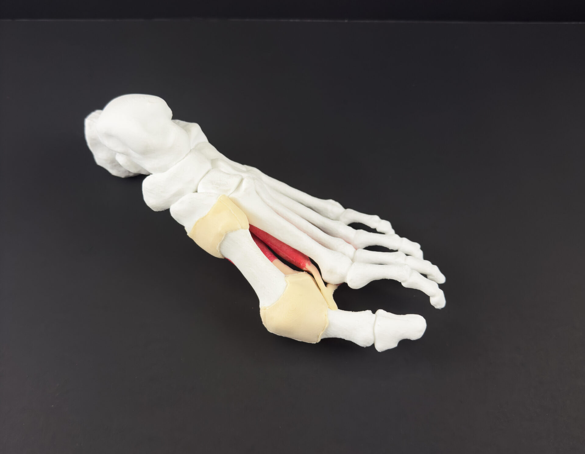 Streamlined Bunion Model - Image 3