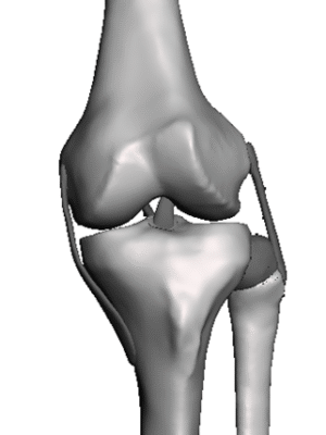 Modified AMOA Knee