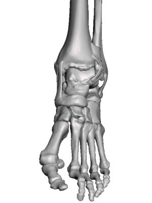Arthritic Ankle Model